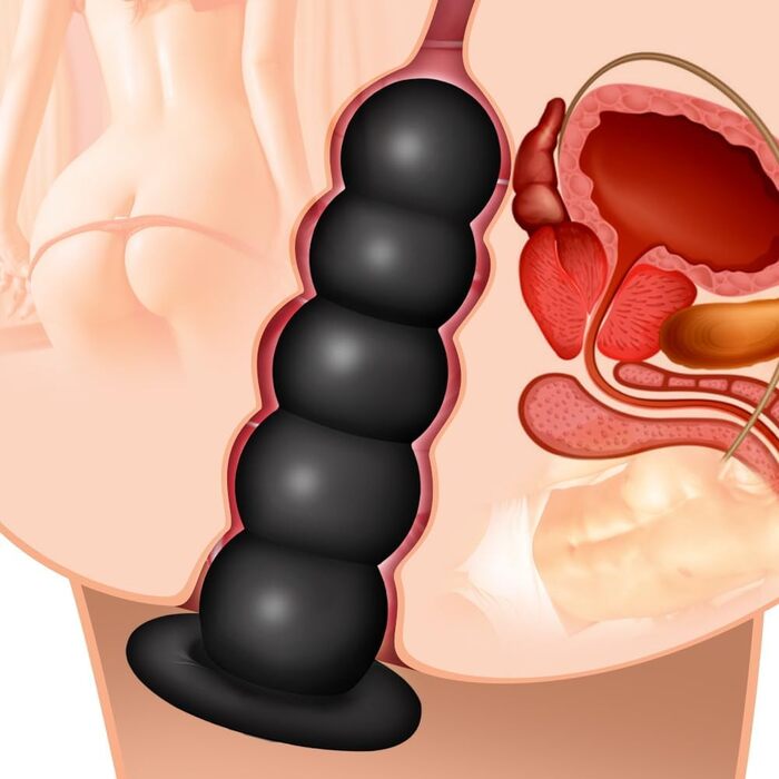 Анал-пробка Roluck з 5 кулями та присоском - іграшка для дорослих (L)