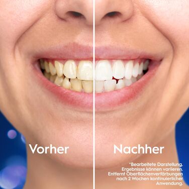 Електрична зубна щітка Oral-B iO Series 6 білого кольору, 5 режимів чищення, набір з 2 насадок, дорожнім футляром та аксесуарами