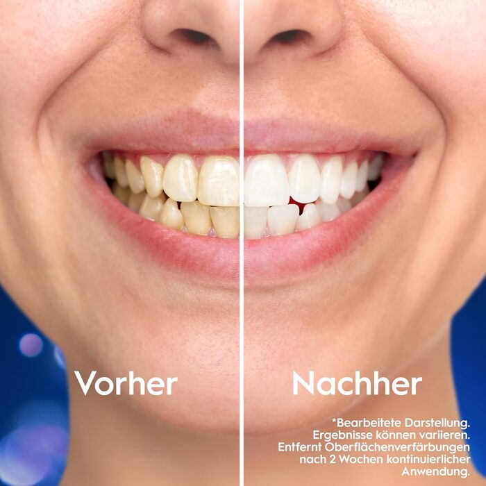 Електрична зубна щітка Oral-B iO Series 6 білого кольору, 5 режимів чищення, набір з 2 насадок, дорожнім футляром та аксесуарами