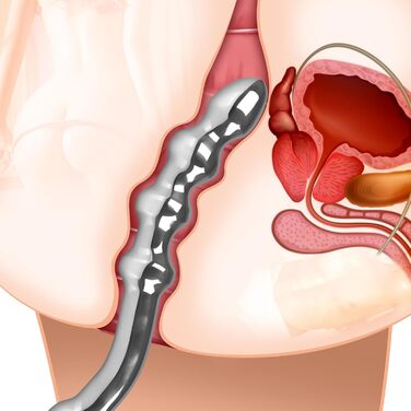 Анальний стимулятор SXOVO з нержавіючої сталі: двійний дildo, масажер простати, для чоловіків та жінок