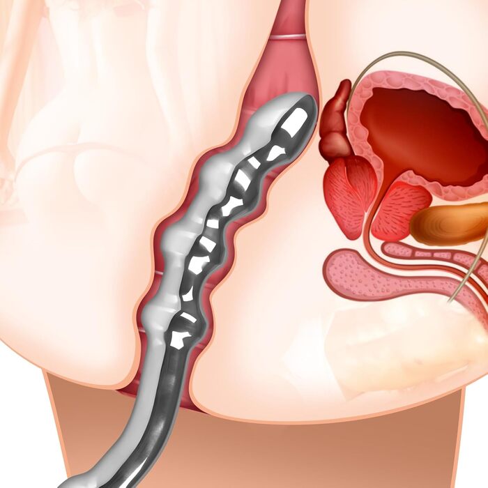 Анальний стимулятор SXOVO з нержавіючої сталі: двійний дildo, масажер простати, для чоловіків та жінок